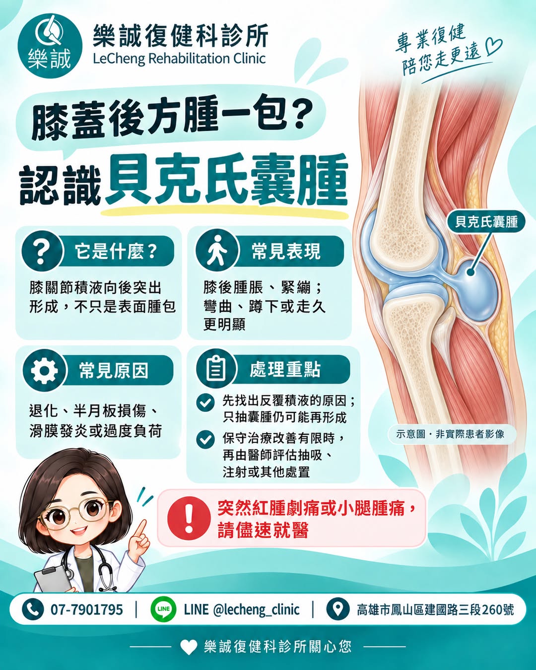 膝蓋後方腫一包?認識貝克氏囊腫衛教圖卡